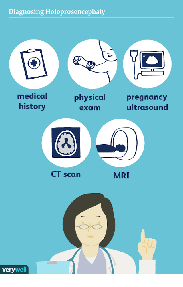 Diagnóstico de holoprosencefalia